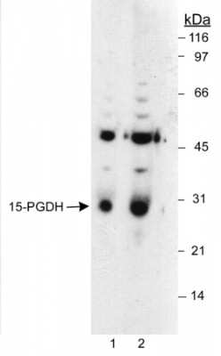 Western Blot: 15-PGDH Antibody [HRP] [NB200-179H] - Detection of 15-PGDH in LoVo whole cell lysates using NB 200-179. Lane 1 uses a 1:6,000 dilution. Lane 2 uses a 1:1,500 dilution. ECL: 10 second exposure.